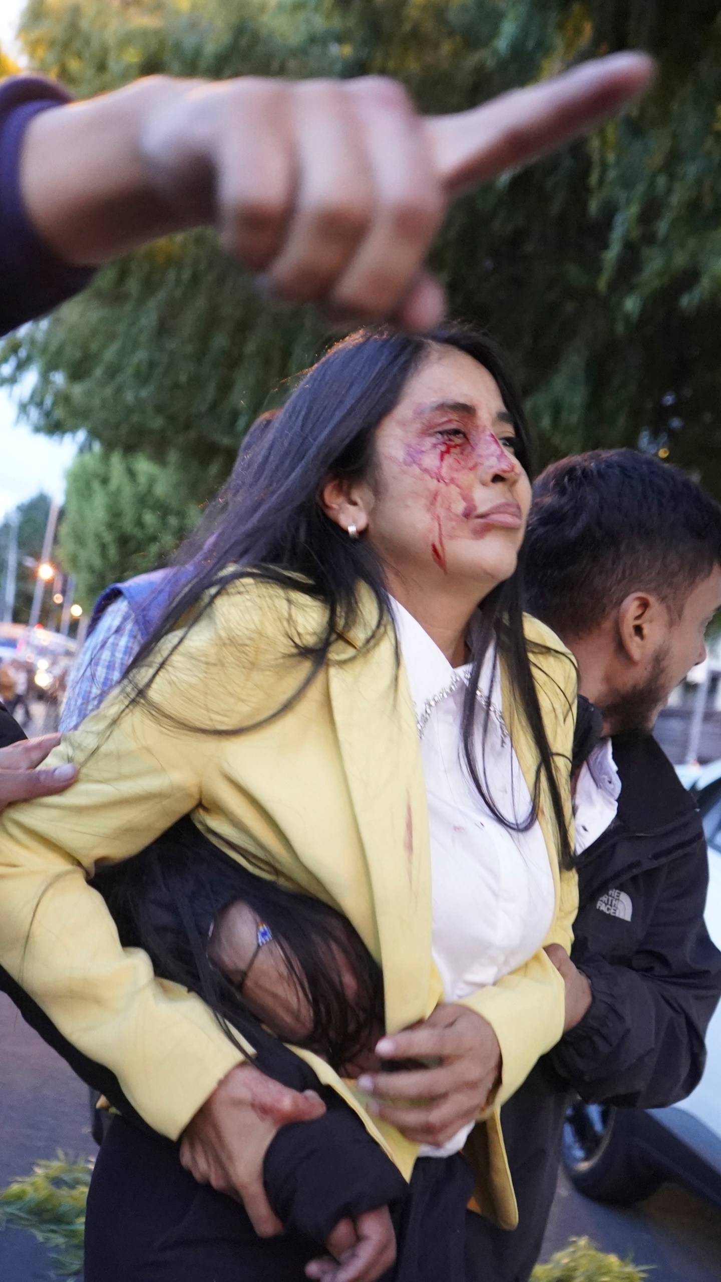 FILE - An injured woman is led away from the scene where presidential candidate Fernando Villavicencio was shot to death at a campaign rally outside a school in Quito, Ecuador, Aug. 9, 2023. Villavicencio, 59, who was known for speaking up against drug cartels, was assassinated less than two weeks before a special presidential election. (API via AP File)